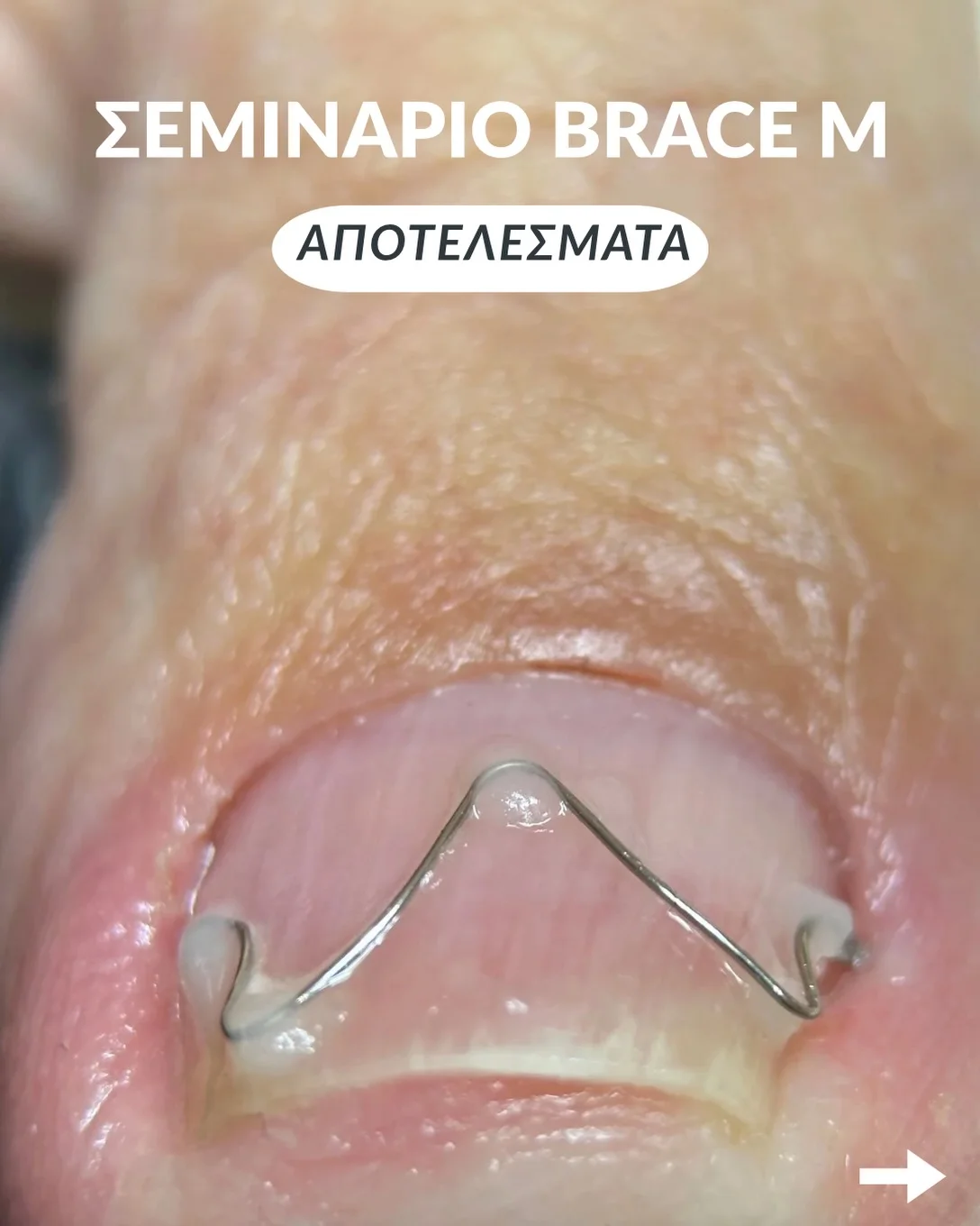 Σεμινάριο Arkada’s Brace M - Slide 2