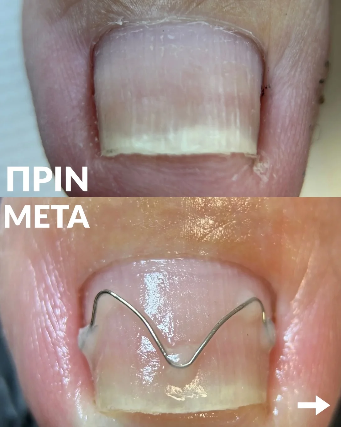 Σεμινάριο Arkada’s Brace M - Slide 3