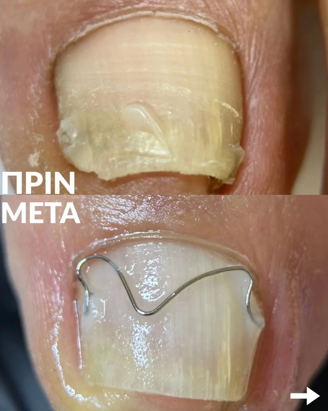 Σεμινάριο Arkada’s Brace M - Slide 4