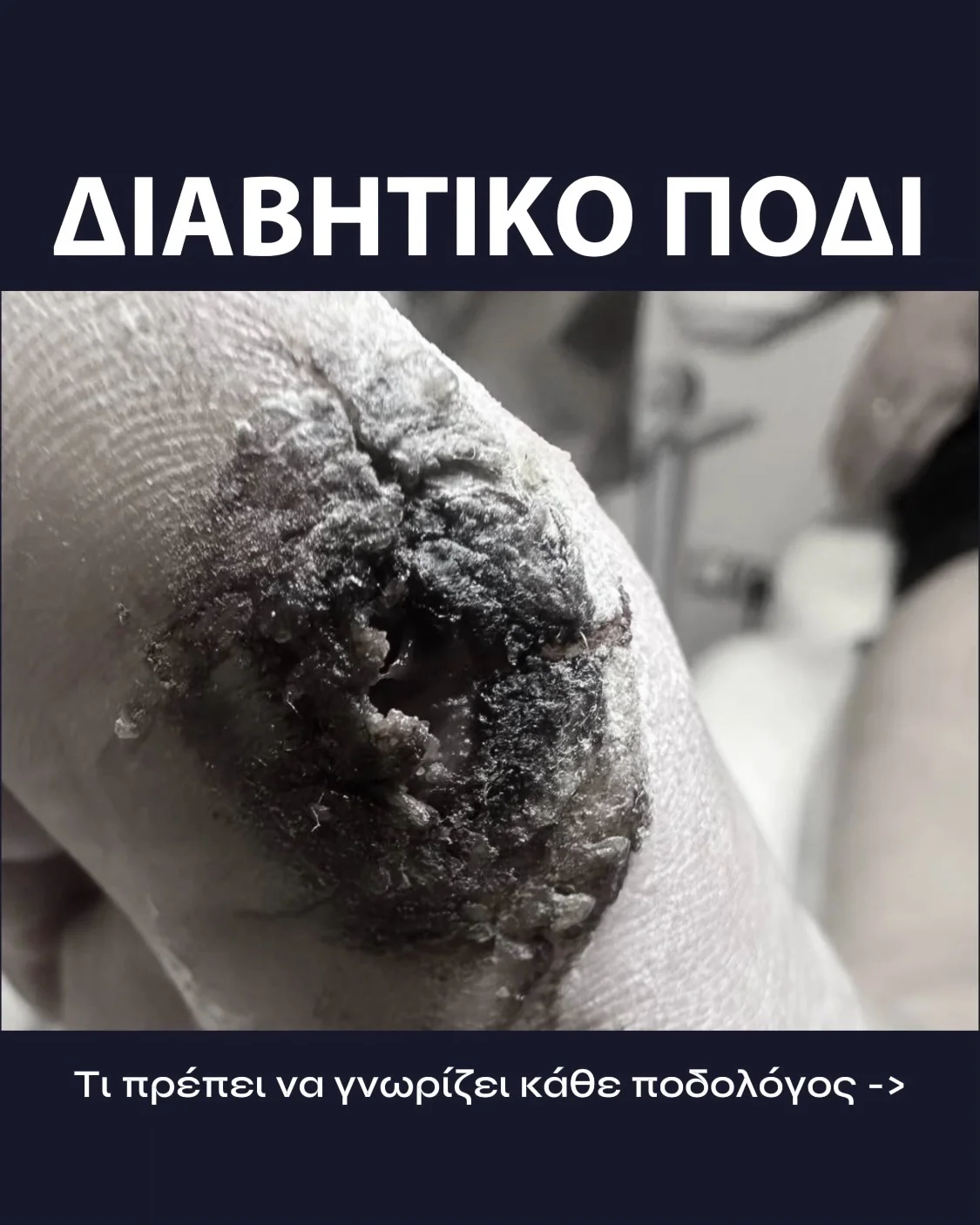 Μετεκπαιδευτικό Σεμινάριο DIAPEDICURE - Slide 4 (Κλινικό Περιστατικό)